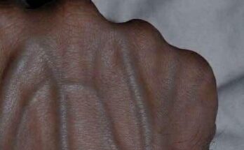 If you have visible veins, it means you are… See more – N-T-N-E-W-S-9-9-9