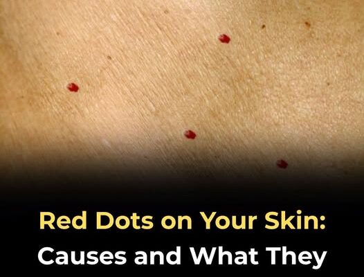 11 Possible Reasons for Red Dots on Your Skin – Dogrupara News