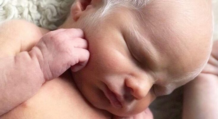 Child With White Hair Faced Bullying — His Journey Years Later Is Truly Inspiring – Dogrupara News