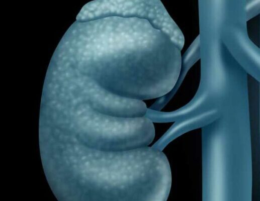 If Your Kidneys Are in Danger, the Body Will Show these 10 Signs – Dogrupara News