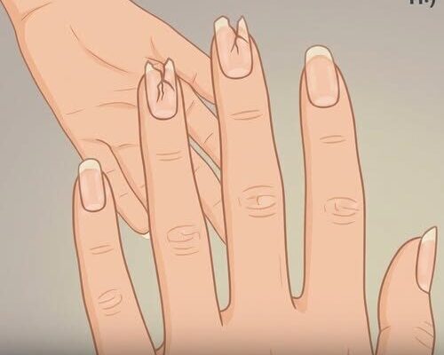 What Your Nails Reveal About Your Health — Warning Signs You Shouldn’t Ignore – Dogrupara News