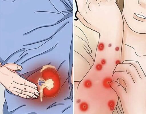 8 Possible Early Warning Signs of Chronic Kidney Disease – Dogrupara News