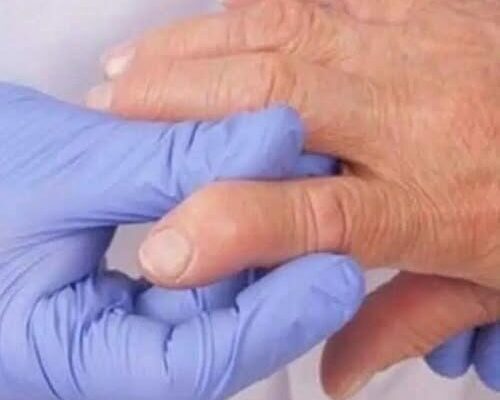 The 10 Worst Foods for Rheumatoid Arthritis (And What to Eat Instead) – Dogrupara News