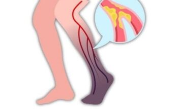 10 Warning Signs of a Blood Clot in the Leg You Should Know – Dogrupara News
