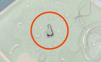 I was taking a shower when I suddenly noticed this on my shoulder. – Dogrupara News