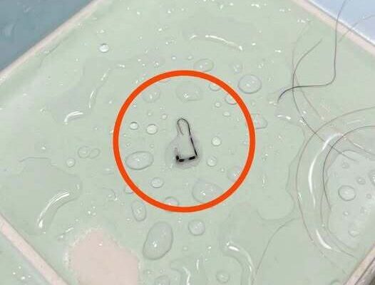 I was taking a shower when I suddenly noticed this on my shoulder. – Dogrupara News
