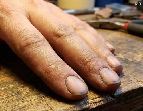 Before You Judge: What Dirty Nails Might Actually Mean – Dogrupara News