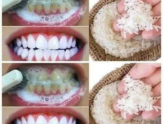 Using rice as a teeth-whitening trick has gained attention as a quick, natural smile brightener, but it