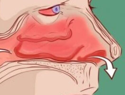 An Easy Self-Care Practice for Sinus Pressure Relief – Dogrupara News
