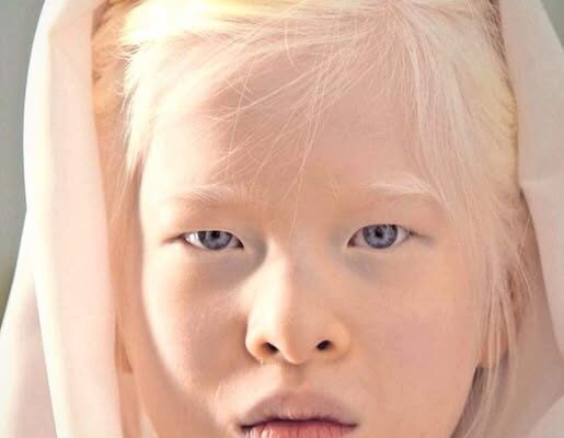 Young Woman Overcomes Early Life Challenges and Becomes a Vogue Model – Dogrupara News