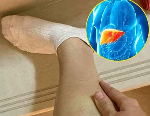 12 Signs of Low Blood Sugar – Dogrupara News