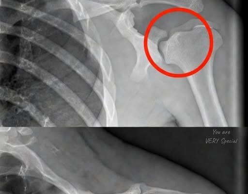 Diet soda is bad for your bones and contains a lot of artificial sweeteners – Dogrupara News