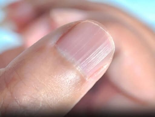 A Doctor Reveals What Your Nails Could Be Telling You About Your Health – Dogrupara News