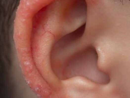 I Noticed Something Unusual on My Child’s Ear — Here’s What I Learned – Dogrupara News