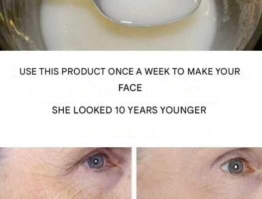Use once a week to make your face look 10 years younger – Dogrupara News