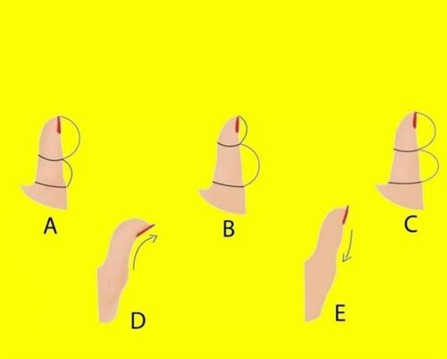 The Secrets Your Thumb Shape Reveals About Your Personality – Dogrupara News