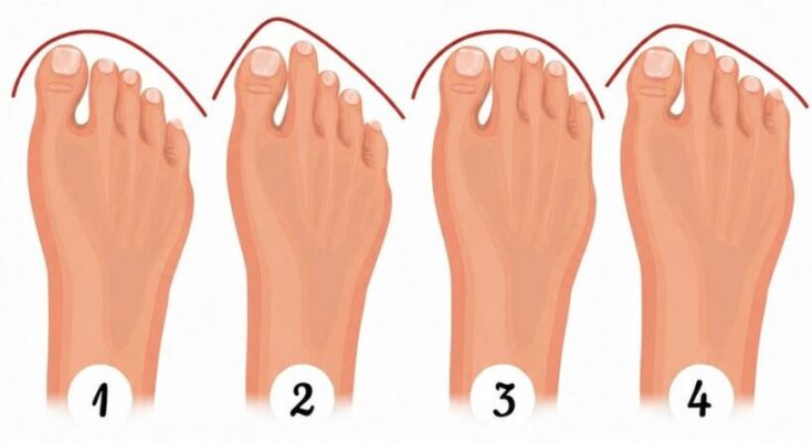 Your Foot Shape Can Reveal Something Fascinating About Your Personality – Dogrupara News