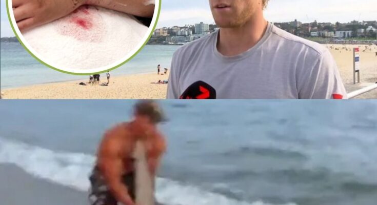 Lifesaver Charlie Verco Reveals Terrifying Shark Encounter and the Survival Advice Everyone Should Know – Openheadline24