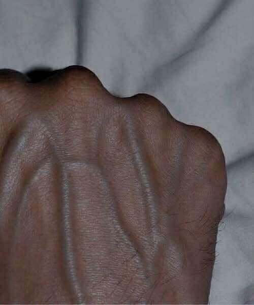 If you have visible veins, it means you are… See more