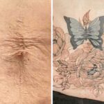 How Scar Cover-Up Tattoos Are Helping People Transform Pain Into Personal Art
