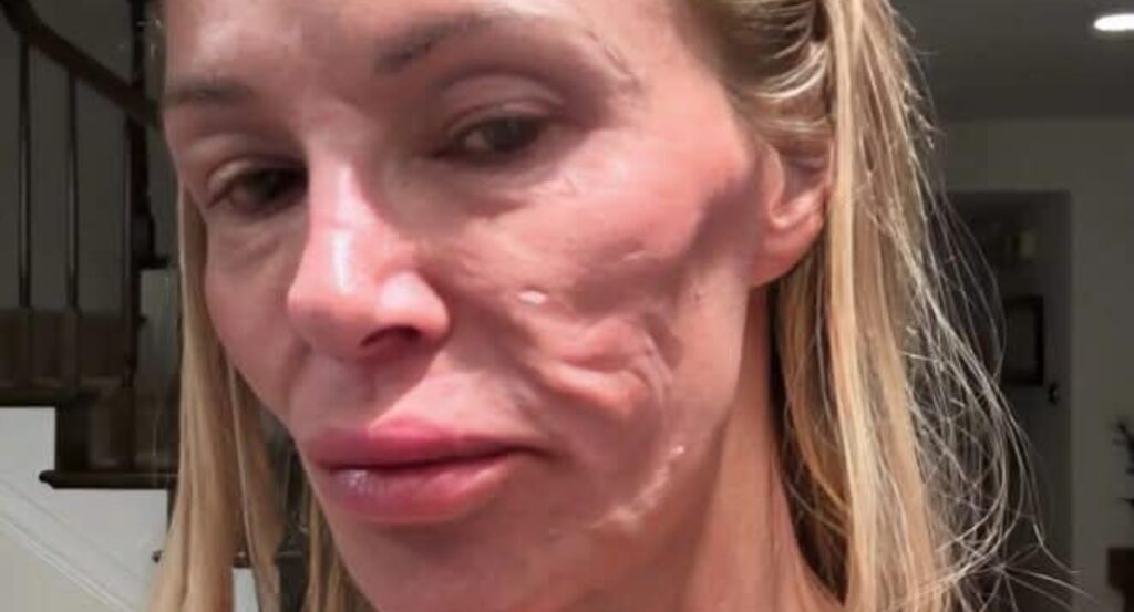 Can You Guess Who She Is?: Health Problems Caused Significant Changes to Her Appearance!