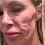Can You Guess Who She Is?: Health Problems Caused Significant Changes to Her Appearance!