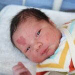 This Boy Was Born With a Heart-Shaped Birthmark and Here is What He Looks Like Now…