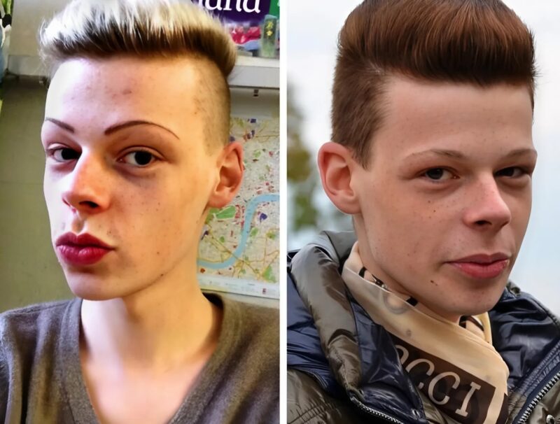 Shocking Transformation: He Spent Millions of Dollars to Get Surgeries and Start Looking Like a Woman…